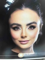 لنز رويال ويژن كره اي - گالری دلربا